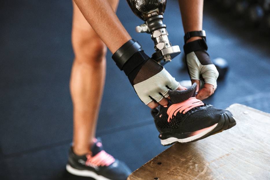 paciente con próstesis en rehabilitación física