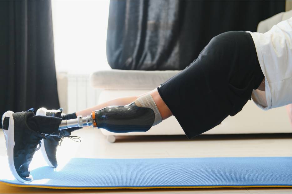 paciente con prótesis haciendo ejercicios de rehabilitación física